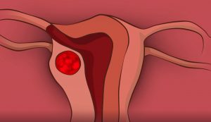patient friendly procedure animation patient friendly procedure animation